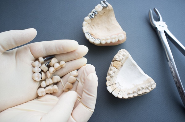 Who Needs A Dental Implant Restoration?