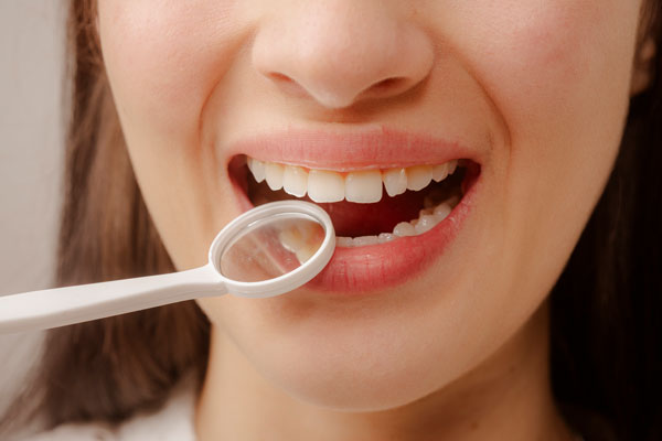 Why Dental Cleanings Remove Plaque And Tartar Deposits