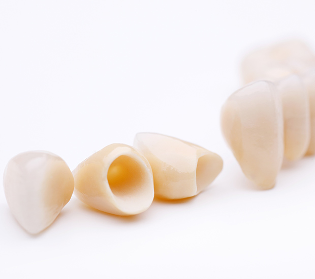 Englewood Dental Crowns and Dental Bridges