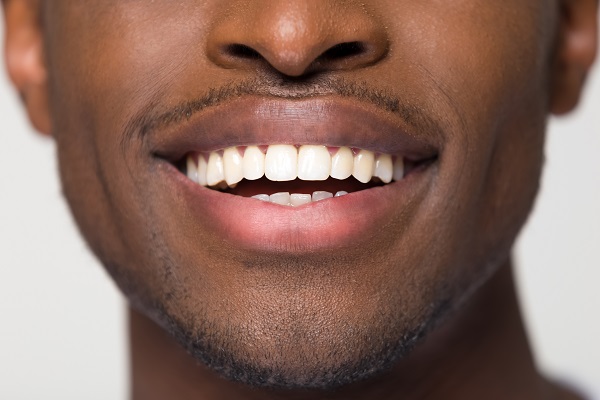 Myths About Teeth Straightening