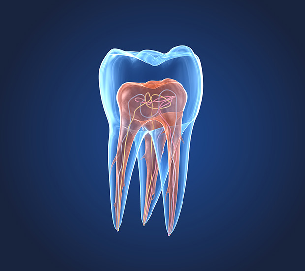 Englewood What is an Endodontist